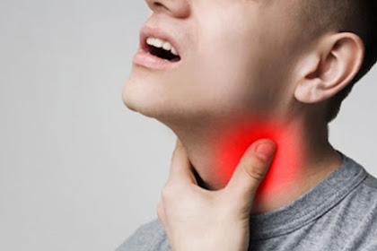 Cara Mengobati Radang Tenggorokan Dengan Cepat